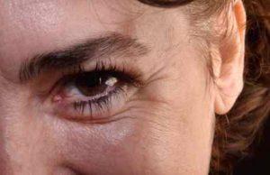 rides de radiofréquence