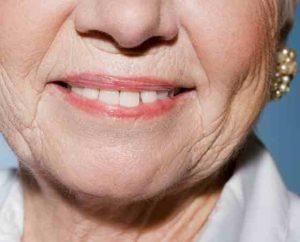 rides de radiofréquence2